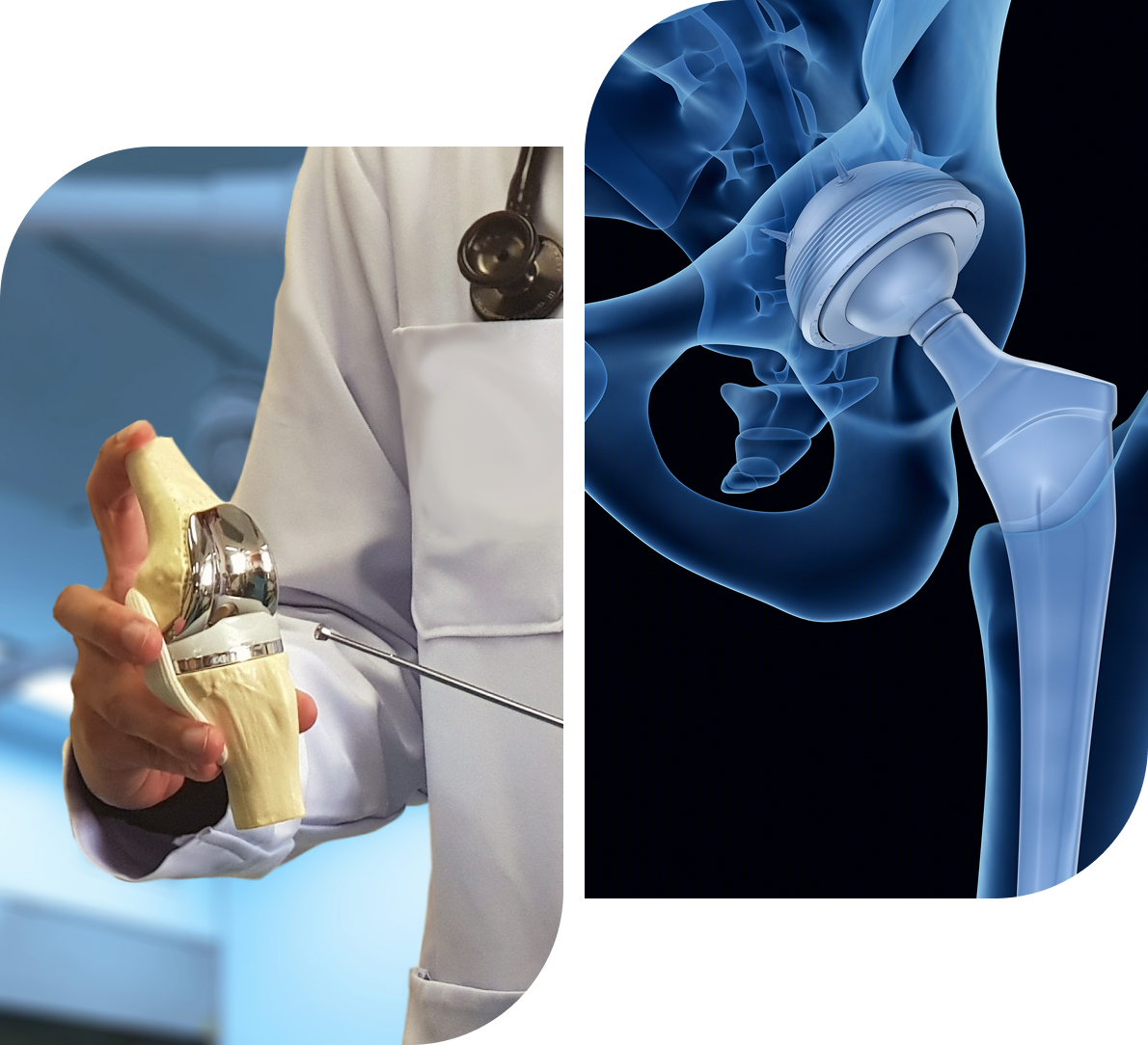 img A surgeon holding a banana and an x-ray of the knee.