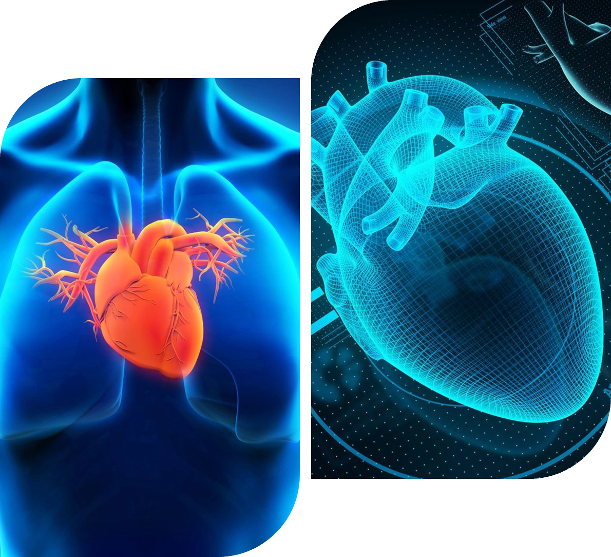 task-48 A picture of an x-ray and a heart.